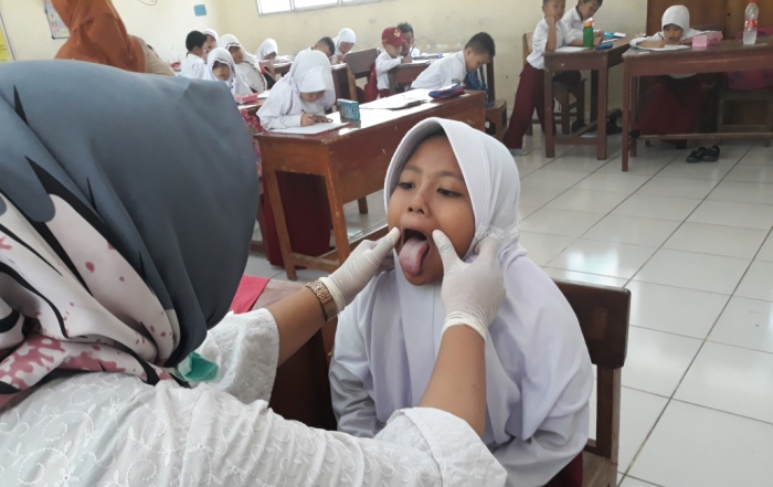 1739104557-layanan-cek-kesehatan-gratis-untuk-siswa-dimulai-juli